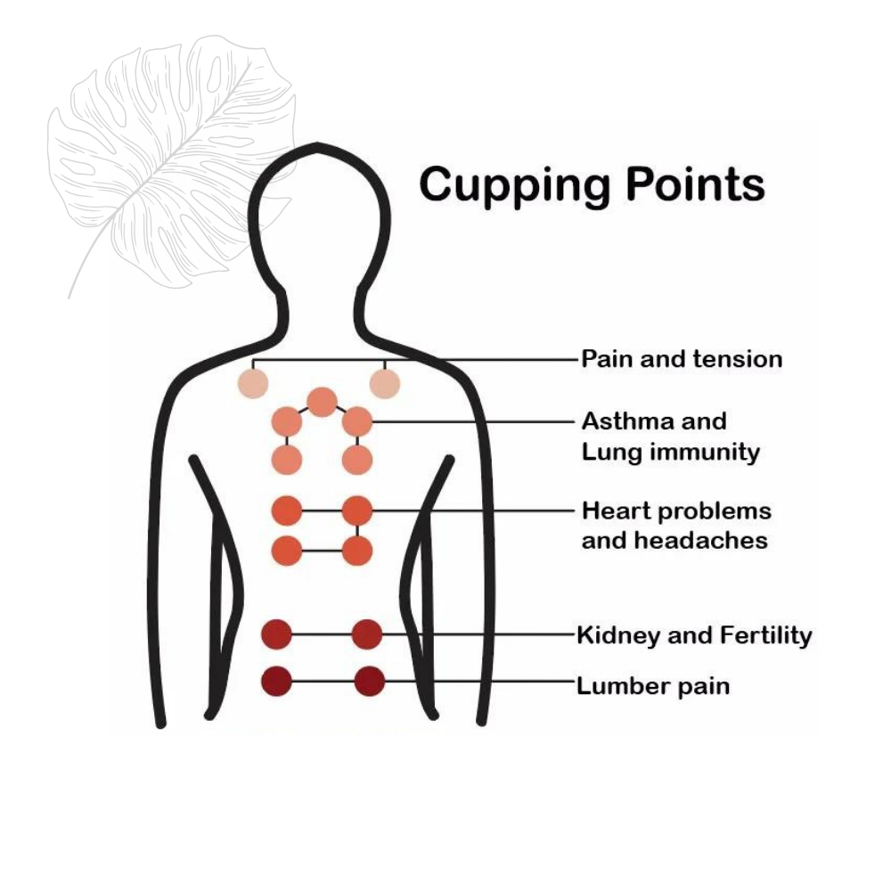 Cupina® - Electric Vacuum Cupping & Anti-Cellulite Therapy Massager